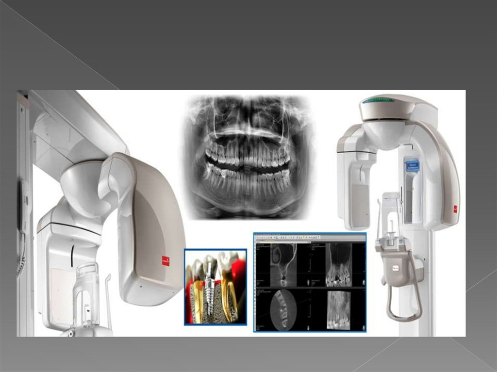 Кт в стоматологии презентация